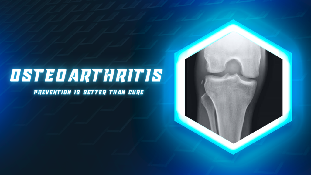Osteoarthritis - prevention is better than cure
